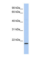 RWDD4A / RWDD4 Antibody - RWDD4 / RWDD4A antibody Western blot of SH-SYSY lysate. This image was taken for the unconjugated form of this product. Other forms have not been tested.