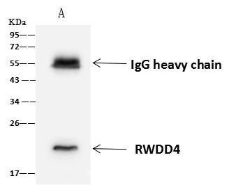 RWDD4A / RWDD4 Antibody - RWDD4 was immunoprecipitated using: Lane A: 0.5 mg SHSY5Y Whole Cell Lysate. 4 uL anti-RWDD4 rabbit polyclonal antibody and 60 ug of Immunomagnetic beads Protein A/G. Primary antibody: Anti-RWDD4 rabbit polyclonal antibody, at 1:100 dilution. Secondary antibody: Goat Anti-Rabbit IgG (H+L)/HRP at 1/10000 dilution. Developed using the ECL technique. Performed under reducing conditions. Predicted band size: 21 kDa. Observed band size: 21 kDa.