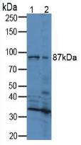 RXFP1/ LGR7 Antibody - Western Blot; Sample. Lane1: Mouse Brain Tissue; Lane2: Mouse Kidney Tissue.