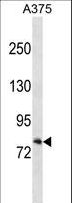RXFP1/ LGR7 Antibody - RXFP1 Antibody western blot of A375 cell line lysates (35 ug/lane). The RXFP1 antibody detected the RXFP1 protein (arrow).