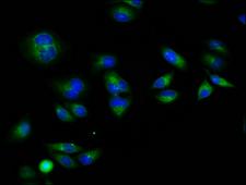 RXFP1/ LGR7 Antibody - Immunofluorescence staining of Hela cells diluted at 1:133, counter-stained with DAPI. The cells were fixed in 4% formaldehyde, permeabilized using 0.2% Triton X-100 and blocked in 10% normal Goat Serum. The cells were then incubated with the antibody overnight at 4°C.The Secondary antibody was Alexa Fluor 488-congugated AffiniPure Goat Anti-Rabbit IgG (H+L).