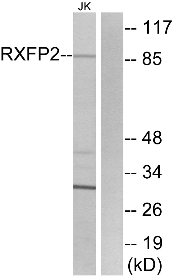 RXFP2 / LGR8 Antibody - Western blot analysis of lysates from Jurkat cells, using RXFP2 Antibody. The lane on the right is blocked with the synthesized peptide.