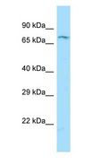 RXFP2 / LGR8 Antibody - RXFP2 / LGR8 antibody Western Blot of Jurkat.  This image was taken for the unconjugated form of this product. Other forms have not been tested.