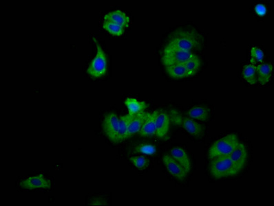 RXFP2 / LGR8 Antibody - Immunofluorescence staining of HepG2 cells at a dilution of 1:130, counter-stained with DAPI. The cells were fixed in 4% formaldehyde, permeabilized using 0.2% Triton X-100 and blocked in 10% normal Goat Serum. The cells were then incubated with the antibody overnight at 4°C.The secondary antibody was Alexa Fluor 488-congugated AffiniPure Goat Anti-Rabbit IgG (H+L) .