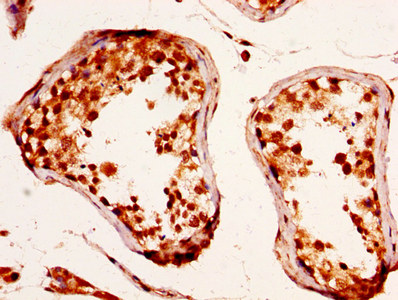 RXFP2 / LGR8 Antibody - Immunohistochemistry image at a dilution of 1:290 and staining in paraffin-embedded human testis tissue performed on a Leica BondTM system. After dewaxing and hydration, antigen retrieval was mediated by high pressure in a citrate buffer (pH 6.0) . Section was blocked with 10% normal goat serum 30min at RT. Then primary antibody (1% BSA) was incubated at 4 °C overnight. The primary is detected by a biotinylated secondary antibody and visualized using an HRP conjugated SP system.