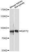 RXFP2 / LGR8 Antibody - Western blot analysis of extracts of various cell lines, using RXFP2 antibody at 1:3000 dilution. The secondary antibody used was an HRP Goat Anti-Rabbit IgG (H+L) at 1:10000 dilution. Lysates were loaded 25ug per lane and 3% nonfat dry milk in TBST was used for blocking. An ECL Kit was used for detection and the exposure time was 30s.