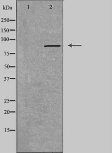 RXFP2 / LGR8 Antibody - Western blot analysis of extracts of Jurkat cells using RXFP2 antibody. The lane on the left is treated with the antigen-specific peptide.