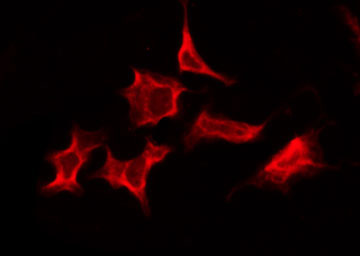 RXFP2 / LGR8 Antibody - Staining HeLa cells by IF/ICC. The samples were fixed with PFA and permeabilized in 0.1% Triton X-100, then blocked in 10% serum for 45 min at 25°C. The primary antibody was diluted at 1:200 and incubated with the sample for 1 hour at 37°C. An Alexa Fluor 594 conjugated goat anti-rabbit IgG (H+L) Ab, diluted at 1/600, was used as the secondary antibody.