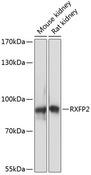 RXFP2 / LGR8 Antibody - Western blot analysis of extracts of various cell lines using RXFP2 Polyclonal Antibody at dilution of 1:3000.