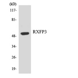 RXFP3 Antibody - Western blot analysis of the lysates from Jurkat cells using RXFP3 antibody.