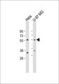 RXFP3 Antibody - All lanes: Anti-GPCR135 Antibody at 1:1000 dilution. Lane 1: HeLa whole cell lysate. Lane 2: U-87 MG whole cell lysate Lysates/proteins at 20 ug per lane. Secondary Goat Anti-Rabbit IgG, (H+L), Peroxidase conjugated at 1:10000 dilution. Predicted band size: 51 kDa. Blocking/Dilution buffer: 5% NFDM/TBST.