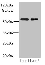 RXFP3 Antibody - Western blot All Lanes: RXFP3 antibody at 3.68ug/ml Lane 1: Jurkat whole cell lysate Lane 2: HepG-2 whole cell lysate Secondary Goat polyclonal to rabbit IgG at 1/10000 dilution Predicted band size: 51 kDa Observed band size: 51 kDa