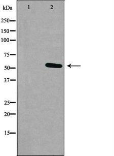 RXFP3 Antibody - Western blot analysis of extracts of K562 cells using RXFP3 antibody. The lane on the left is treated with the antigen-specific peptide.