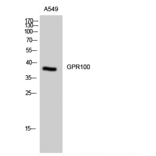 RXFP4 / GPR100 Antibody - Western blot of GPR100 antibody