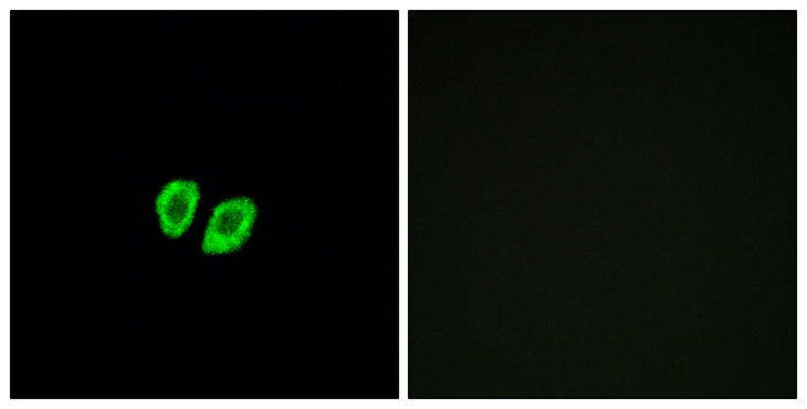 RXFP4 / GPR100 Antibody - Immunofluorescence analysis of A549 cells, using RXFP4 Antibody. The picture on the right is blocked with the synthesized peptide.