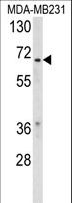 RXRB Antibody - Western blot of RXRB Antibody in MDA-MB231 cell line lysates (35 ug/lane). RXRB (arrow) was detected using the purified antibody.
