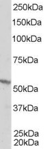 RXRB Antibody - Staining (1 ug/ml) of A431 lysate (RIPA buffer, 35 ug total protein per lane). Primary incubated for 1 hour. Detected by chemiluminescence.