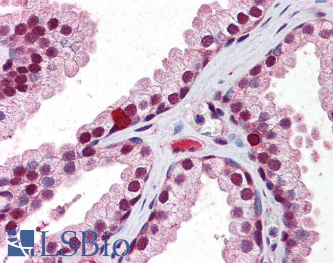RXRB Antibody - Anti-RXRB antibody IHC of human prostate. Immunohistochemistry of formalin-fixed, paraffin-embedded tissue after heat-induced antigen retrieval. Antibody concentration 2.5 ug/ml.  This image was taken for the unconjugated form of this product. Other forms have not been tested.