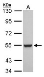 RXRB Antibody - Sample (30 ug of whole cell lysate). A: A431. 7.5% SDS PAGE. RXRB antibody diluted at 1:1000. 