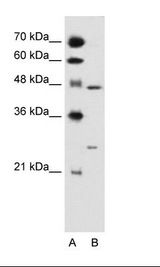 RXRG Antibody - A: Marker, HepG2 Cell Lysate.  This image was taken for the unconjugated form of this product. Other forms have not been tested.