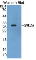RXRG Antibody - Western blot of RXRG antibody.
