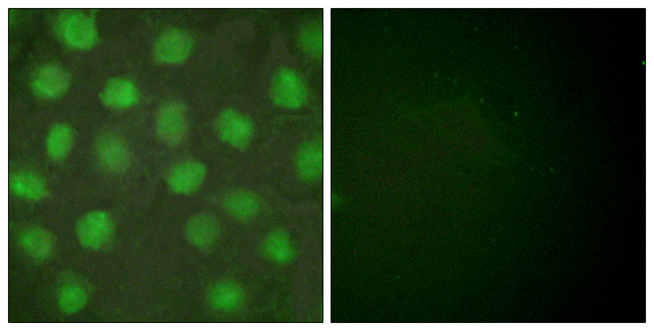 RXRG Antibody - Immunofluorescence analysis of HUVEC cells, using Retinoid X Receptor gamma Antibody. The picture on the right is blocked with the synthesized peptide.