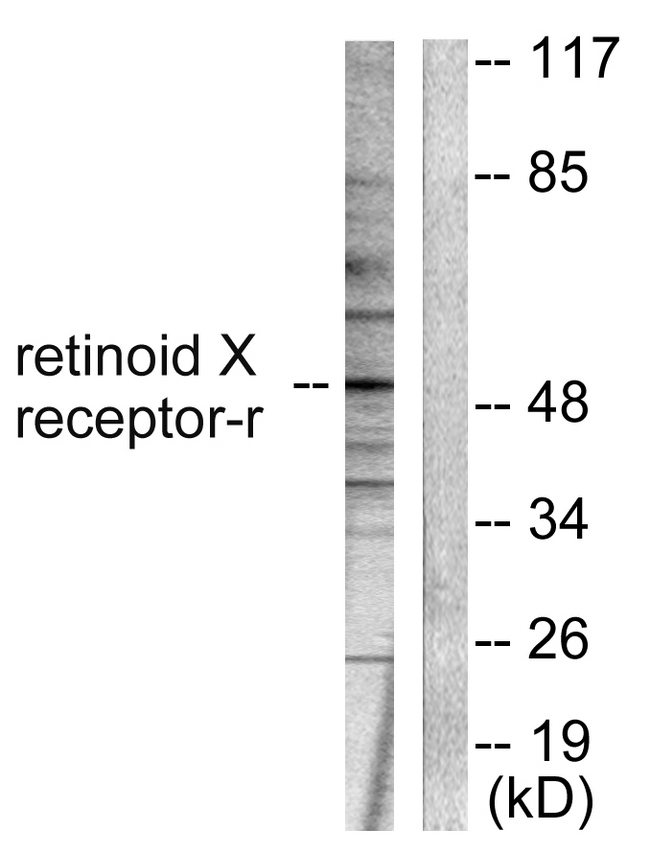 RXRG Antibody - Western blot analysis of lysates from HepG2 cells, using Retinoid X Receptor gamma Antibody. The lane on the right is blocked with the synthesized peptide.