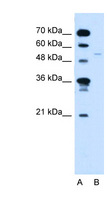 RXRG Antibody - RXRG antibody ARP38881_T100-NP_008848-RXRG(retinoid X receptor, gamma) Antibody Western blot of Jurkat lysate.  This image was taken for the unconjugated form of this product. Other forms have not been tested.