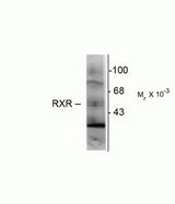 RXRG Antibody - RXRG Antibody in Western Blot (WB)