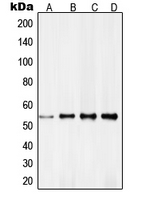 RXRG Antibody - Western blot analysis of RXR gamma expression in HeLa (A); NIH3T3 (B); MCF7 (C); A431 (D) whole cell lysates.