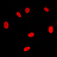 RXRG Antibody - Immunofluorescent analysis of RXR gamma staining in NIH3T3 cells. Formalin-fixed cells were permeabilized with 0.1% Triton X-100 in TBS for 5-10 minutes and blocked with 3% BSA-PBS for 30 minutes at room temperature. Cells were probed with the primary antibody in 3% BSA-PBS and incubated overnight at 4 C in a humidified chamber. Cells were washed with PBST and incubated with a DyLight 594-conjugated secondary antibody (red) in PBS at room temperature in the dark. DAPI was used to stain the cell nuclei (blue).
