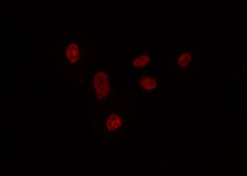 RXRG Antibody - Staining HepG2 cells by IF/ICC. The samples were fixed with PFA and permeabilized in 0.1% Triton X-100, then blocked in 10% serum for 45 min at 25°C. The primary antibody was diluted at 1:200 and incubated with the sample for 1 hour at 37°C. An Alexa Fluor 594 conjugated goat anti-rabbit IgG (H+L) Ab, diluted at 1/600, was used as the secondary antibody.