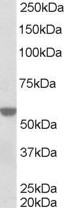 RXTA / RXR-Alpha Antibody - (0.5 ug/ml) Staining of A431 lysate (35 ug protein in RIPA buffer). Primary incubation was 1 hour. Detected by chemiluminescence.