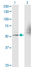 RXTA / RXR-Alpha Antibody - Western blot of RXRA expression in transfected 293T cell line by RXRA monoclonal antibody (M17), clone 1G1.