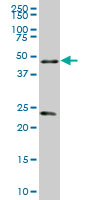 RXTA / RXR-Alpha Antibody - RXRA monoclonal antibody (M02), clone 4D6. Western blot of RXRA expression in human lung cancer.