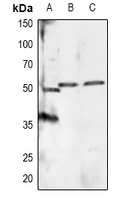 RXTA / RXR-Alpha Antibody - Western blot analysis of RXR alpha (pS260) expression in Hela (A), mouse brain (B), rat brain (C) whole cell lysates.