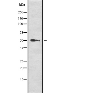 RXTA / RXR-Alpha Antibody - Western blot analysis of RXRA using Jurkat whole cells lysates