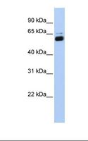 RXTA / RXR-Alpha Antibody - Transfected 293T cell lysate. Antibody concentration: 1.0 ug/ml. Gel concentration: 12%.  This image was taken for the unconjugated form of this product. Other forms have not been tested.