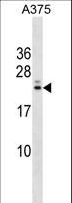 RYBP Antibody - RYBP Antibody western blot of A375 cell line lysates (35 ug/lane). The RYBP antibody detected the RYBP protein (arrow).