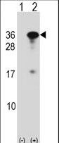 RYBP Antibody - Western blot of RYBP (arrow) using rabbit polyclonal RYBP Antibody. 293 cell lysates (2 ug/lane) either nontransfected (Lane 1) or transiently transfected (Lane 2) with the RYBP gene.