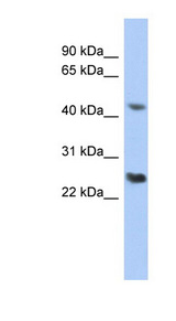RYBP Antibody - RYBP antibody Western blot of THP-1 cell lysate. This image was taken for the unconjugated form of this product. Other forms have not been tested.