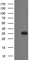 RYBP Antibody - HEK293T cells were transfected with the pCMV6-ENTRY control (Left lane) or pCMV6-ENTRY RYBP (Right lane) cDNA for 48 hrs and lysed. Equivalent amounts of cell lysates (5 ug per lane) were separated by SDS-PAGE and immunoblotted with anti-RYBP.