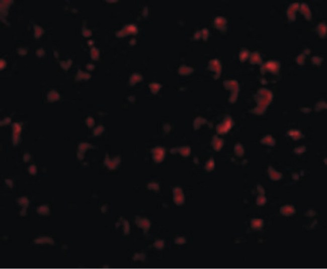 RYBP Antibody - Immunofluorescence of DEDAF in A549 cells with DEDAF antibody at 20 ug/ml.
