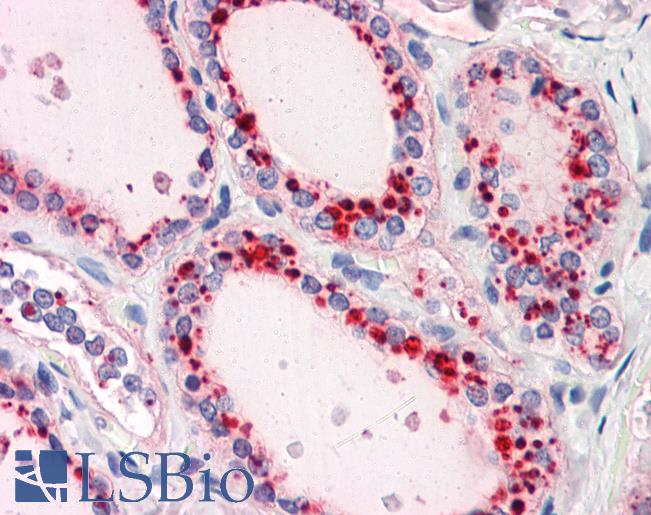 RYBP Antibody - Anti-RYBP antibody IHC of human thyroid. Immunohistochemistry of formalin-fixed, paraffin-embedded tissue after heat-induced antigen retrieval. Antibody concentration 5 ug/ml.  This image was taken for the unconjugated form of this product. Other forms have not been tested.