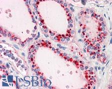 RYBP Antibody - Anti-RYBP antibody IHC of human thyroid. Immunohistochemistry of formalin-fixed, paraffin-embedded tissue after heat-induced antigen retrieval. Antibody concentration 5 ug/ml.  This image was taken for the unconjugated form of this product. Other forms have not been tested.