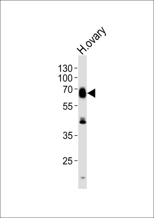 RYK Antibody - Western blot of lysate from human ovary tissue lysate, using RYK Antibody (N175). Antibody was diluted at 1:1000. A goat anti-rabbit IgG H&L (HRP) at 1:10000 dilution was used as the secondary antibody. Lysate at 20ug.