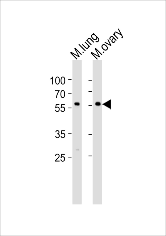 RYK Antibody - Western blot of lysates from mouse lung and ovary tissue lysate(from left to right), using RYK Antibody (N175). Antibody was diluted at 1:1000 at each lane. A goat anti-rabbit IgG H&L (HRP) at 1:5000 dilution was used as the secondary antibody. Lysates at 35ug per lane.