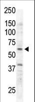 RYK Antibody - The anti-RYK antibody is used in Western blot to detect RYK in Jurkat cell lysate.