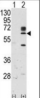 RYK Antibody - Western blot of RYK (arrow) using rabbit polyclonal RYK Antibody.293 cell lysates (2 ug/lane) either nontransfected (Lane 1) or transiently transfected with the RYK gene (Lane 2) (Origene Technologies).