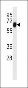 RYK Antibody - RYK western blot of U251 cell line lysates (35 ug/lane). The RYK antibody detected the RYK protein (arrow).